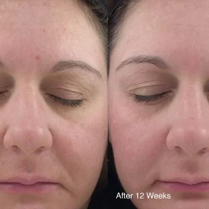 Obagi 360 Exfoliating Cleanser 150ml - Image 3