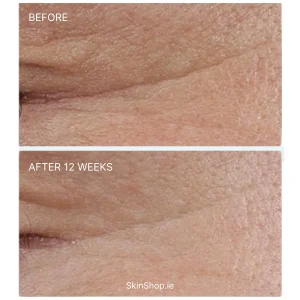 SkinCeuticals P-Tiox 30ml - Image 4