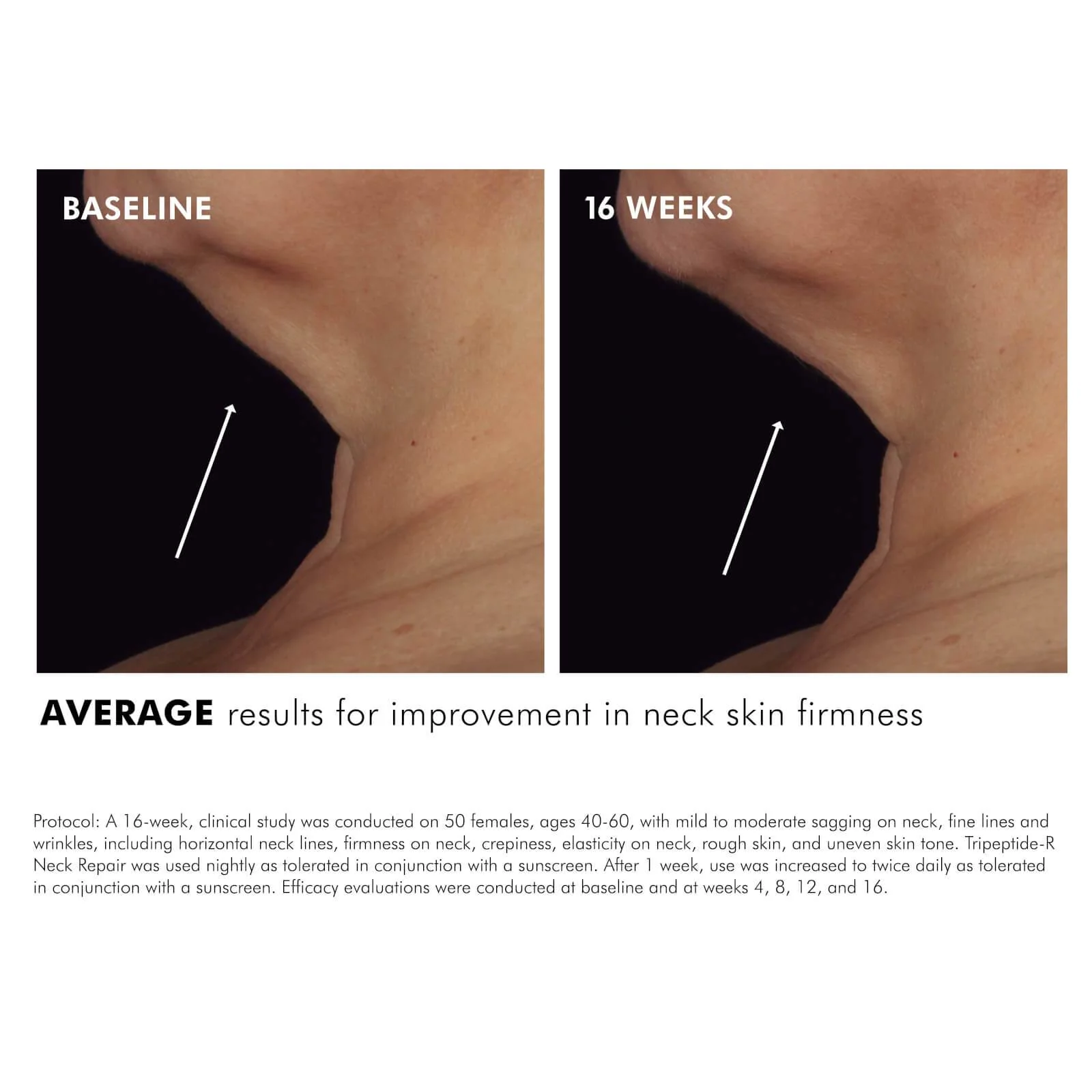 SkinCeuticals Tripeptide -R Neck Repair 50ml - Image 2