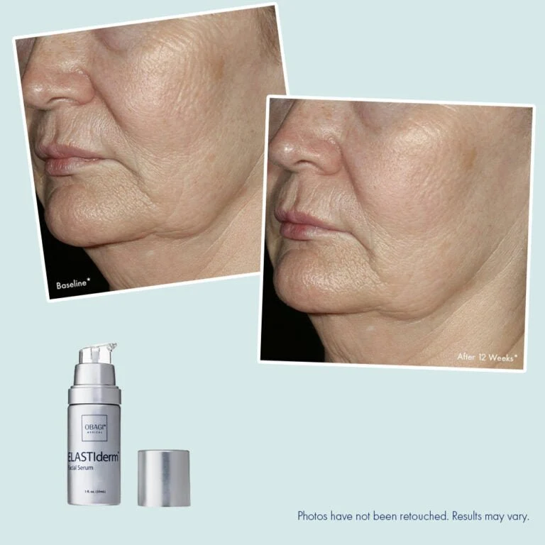 Obagi ELASTIderm Facial Serum 30ml - Image 3